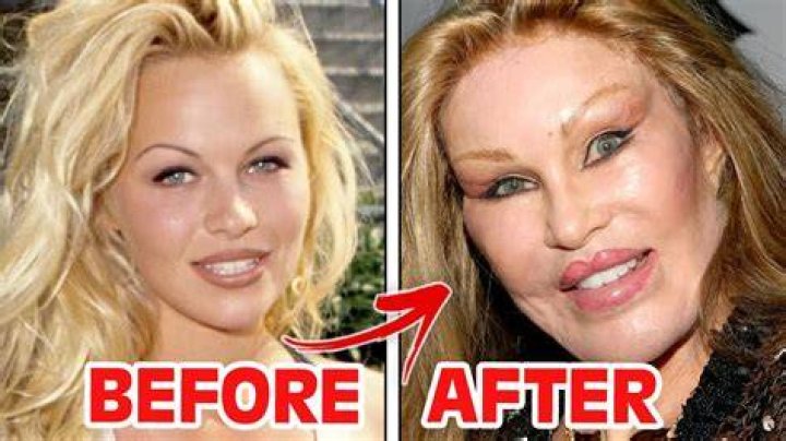 
Jocelyn Wildenstein Plastic Surgery Gone Wrong! Before And After Photos 