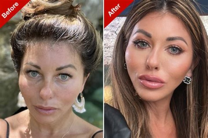 
Mariam Musa Before And After Photos On IG – Has She Done Plastic Surgery? 
