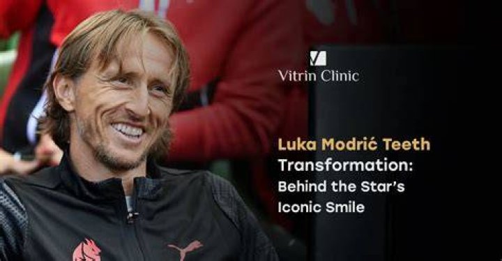 
What Is Wrong With Luka Modric Teeth? 